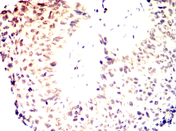 CDKN1A Antibody