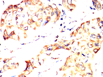 ESR1 Antibody