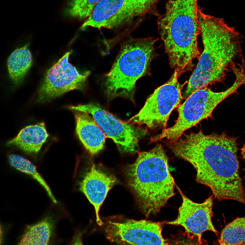 MMP3 Antibody