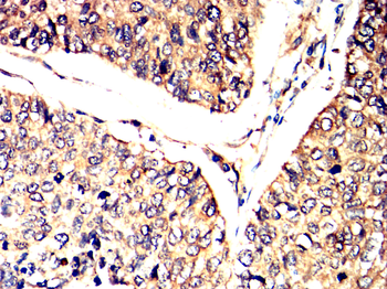 INSR Antibody