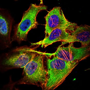 TNFRSF1B Antibody