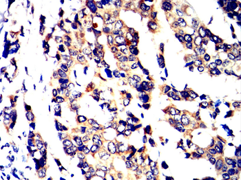 TNFRSF1B Antibody