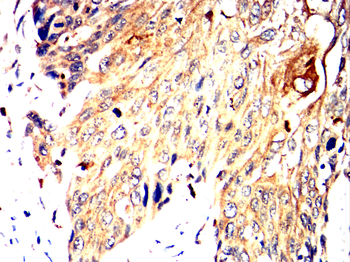 TNFRSF1B Antibody