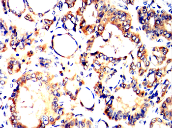 TNFRSF1B Antibody