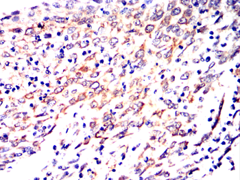 FGF21 Antibody
