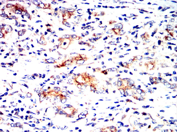 FGF21 Antibody
