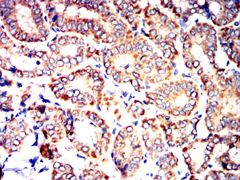 FGF21 Antibody
