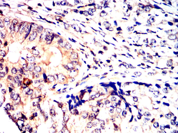 NGF Antibody