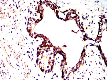 NGF Antibody