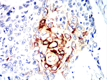 ACACA Antibody