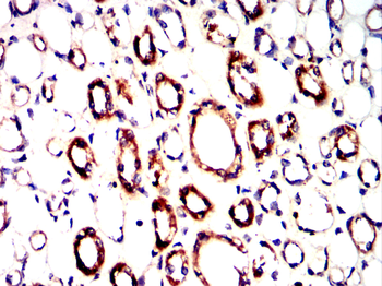 ACACA Antibody