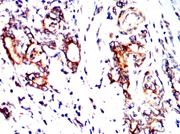 ACACA Antibody