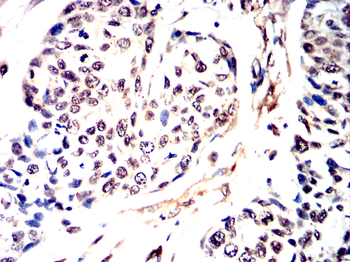CEBPB Antibody