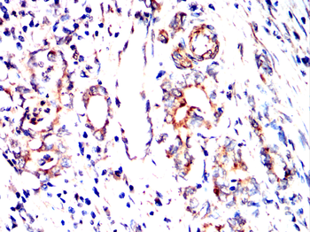 CEBPB Antibody