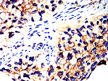CDH1 Antibody