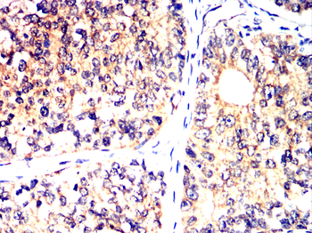MAP3K7 Antibody