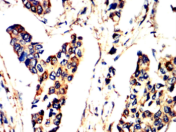 ACLY Antibody