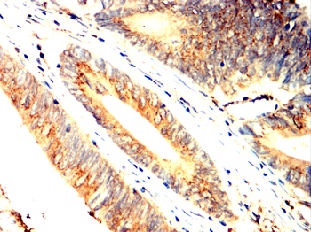 ACLY Antibody