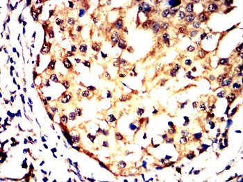 S100A6 Antibody