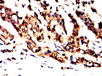S100A6 Antibody
