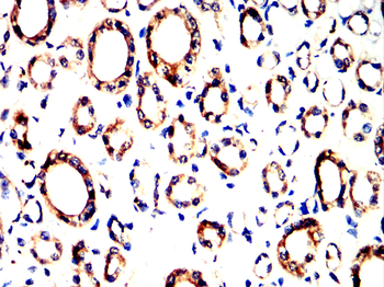 S100A6 Antibody