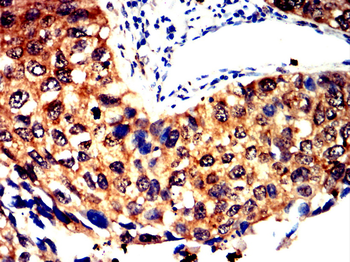 S100A6 Antibody