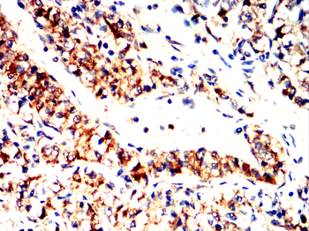 S100A6 Antibody