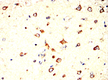 HK1 Antibody