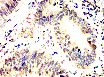 PRKAA1 Antibody