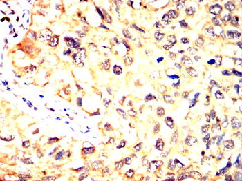 KRT15 Antibody