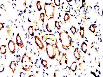 CASP6 Antibody