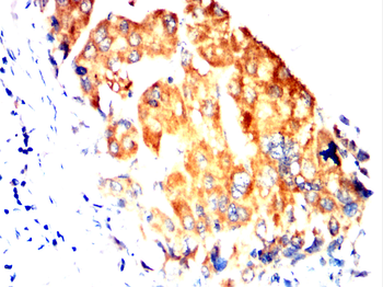 CASP6 Antibody