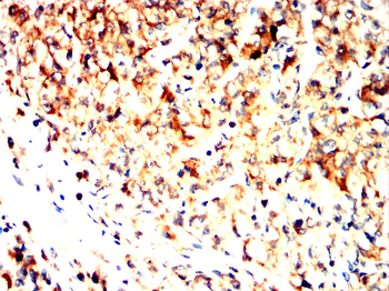 CASP6 Antibody