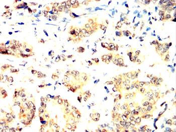 PFKFB3 Antibody