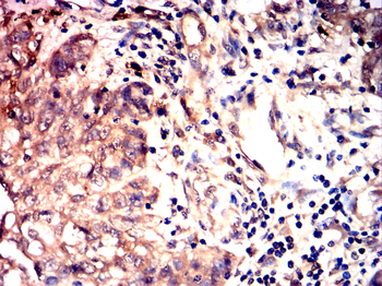 PFKFB3 Antibody