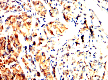 PFKFB3 Antibody