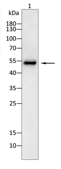 PFKFB3 Antibody