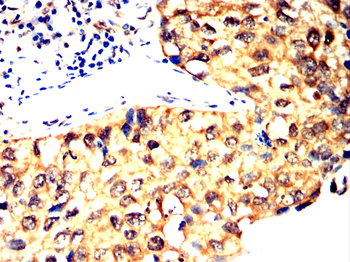 ARHGEF2 Antibody