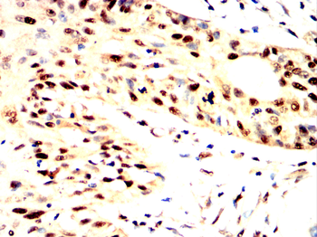 UBA1 Antibody