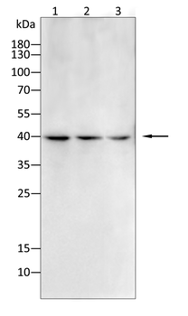 CD1A Antibody