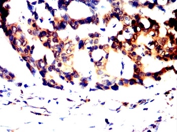 SPHK1 Antibody