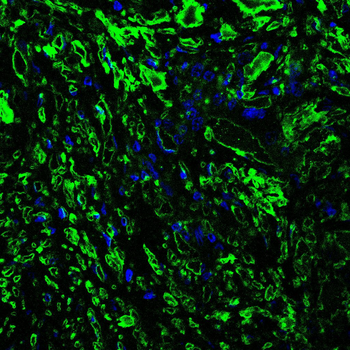 SPHK1 Antibody