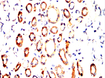 TUBG1 Antibody