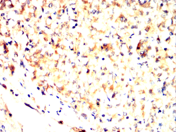 TUBG1 Antibody