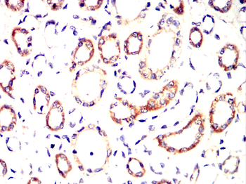 MMP1 Antibody