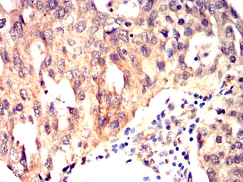 MMP1 Antibody