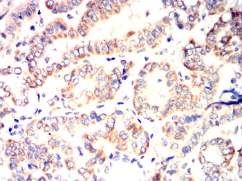 MMP1 Antibody