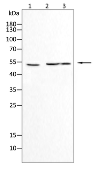 MMP1 Antibody
