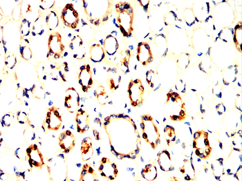 LDHB Antibody