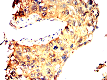 LDHB Antibody